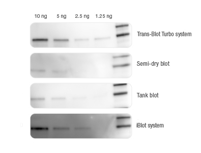 BIO-RAD Trans-Blot®Turbo美國(guó)伯樂(lè)全能型蛋白轉(zhuǎn)印系統(tǒng)1704150
